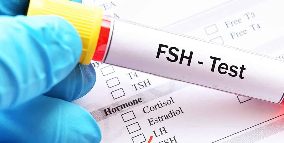 FSH test